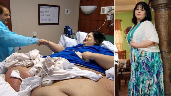 Почему самая толстая женщина похудела