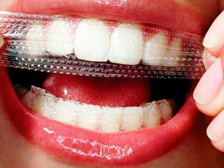 Отбеливающие полоски для зубов: что это такое и как это действует?